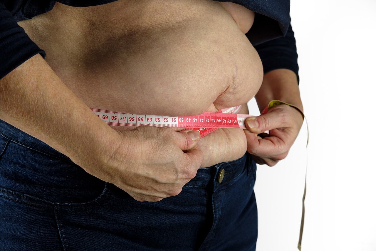 Negativa de cirurgia bariátrica 1 - Imagem de uma pessoa gorda branca medindo sua barriga com uma fita métrica